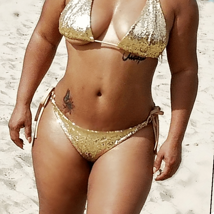 Abdominoplastia Plus
